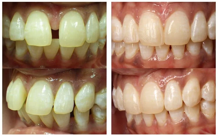 before-after-swapped.jpg
