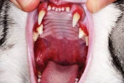 What is Stomatitis? 