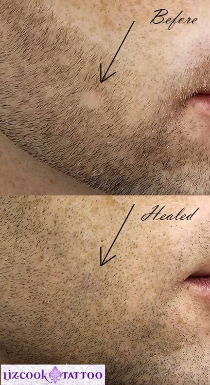 Liz Cook Tattoo PMU Hair Restoration Beard Bald Spot Before Healed.jpg