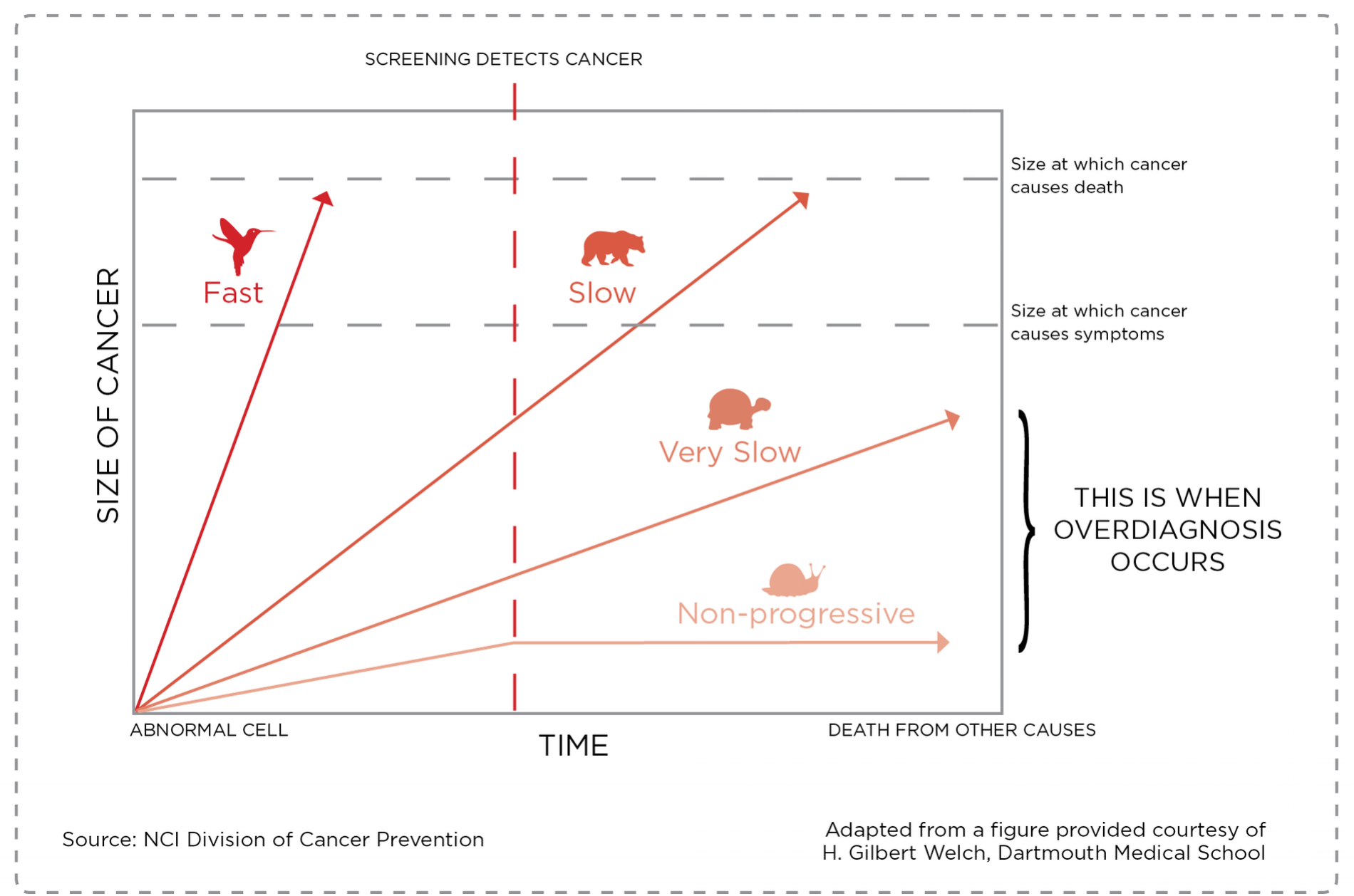 NCI Division of Cancer Prevention, on overdiagnosis