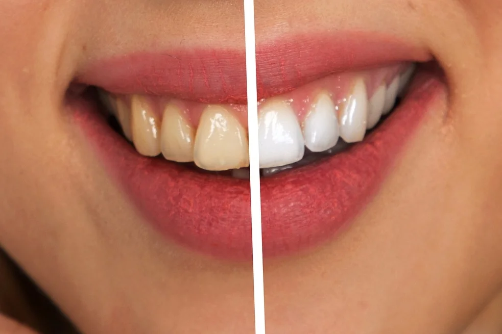 Polished Dental Care