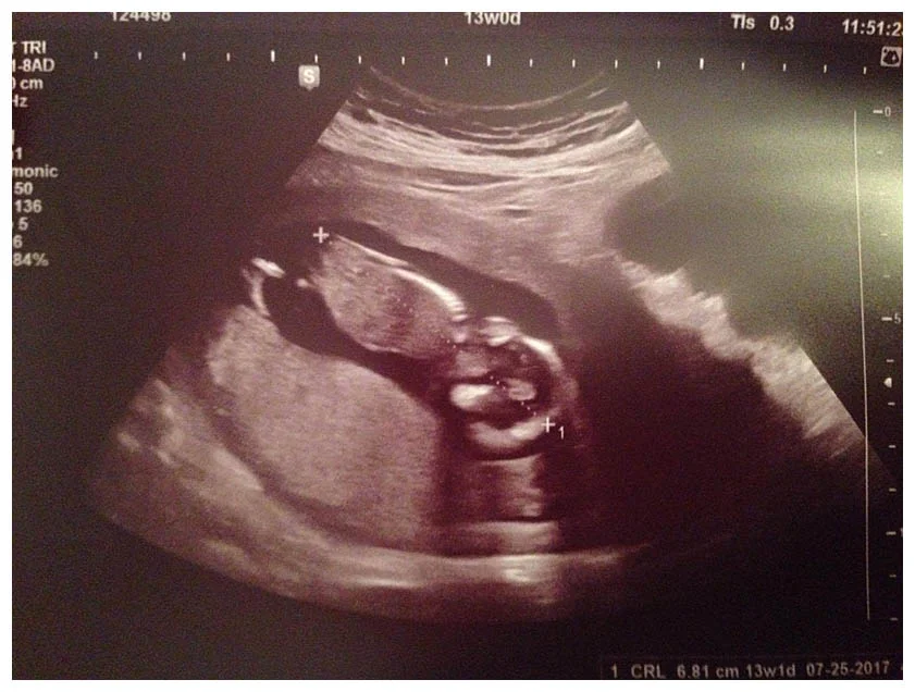 little bub at 13 weeks