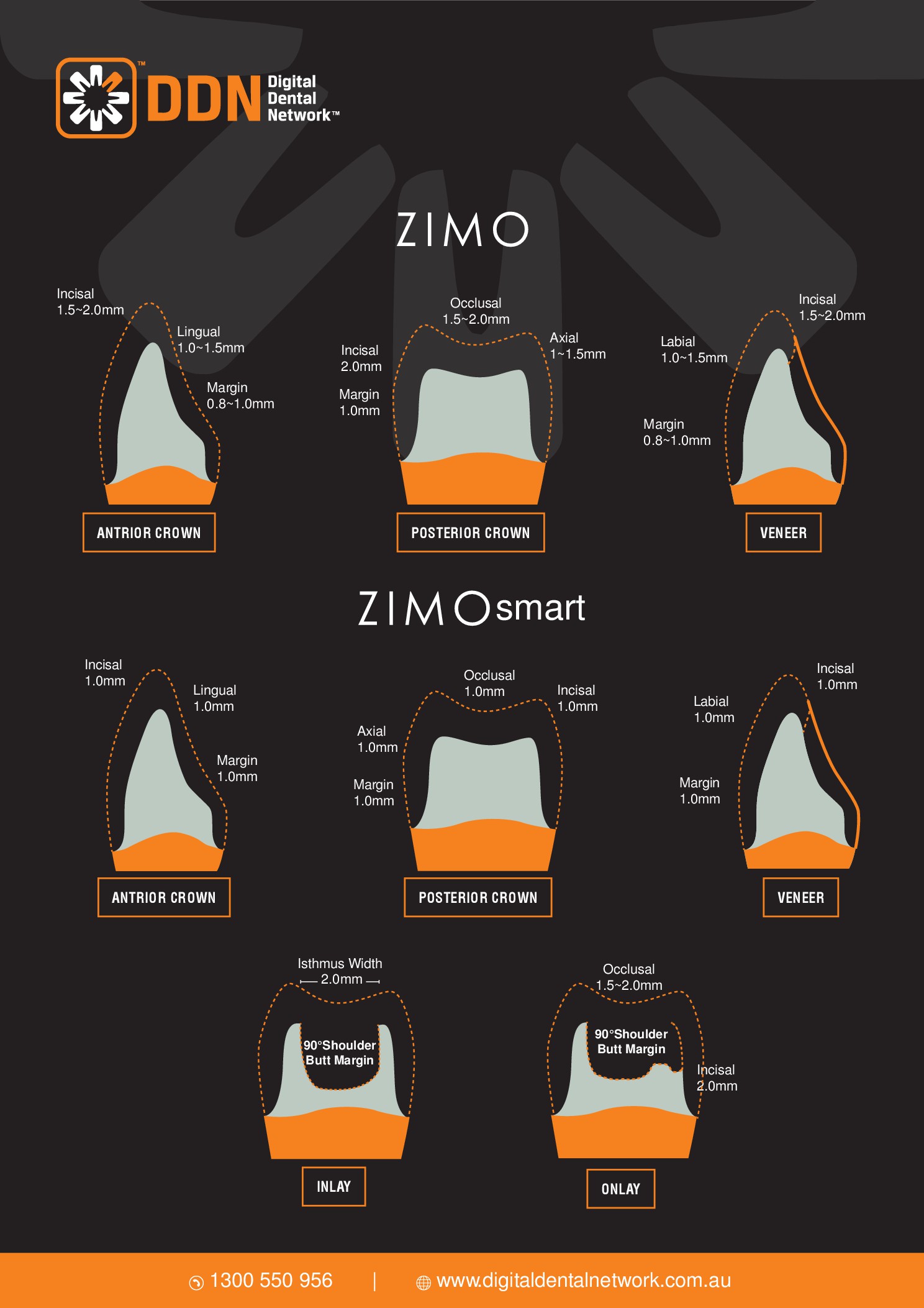 Tooth preparation guide