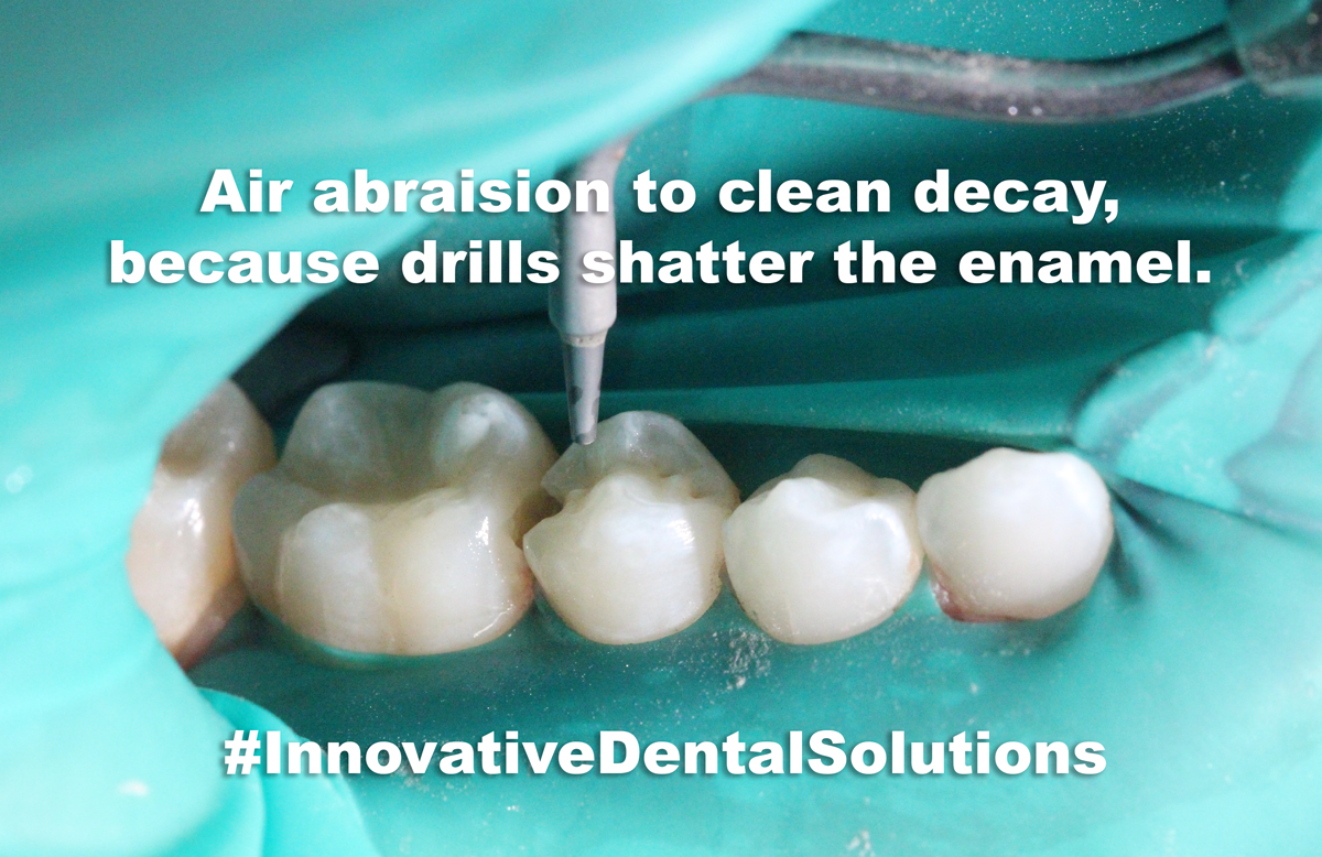 Gallery — Innovative Dental Solutions