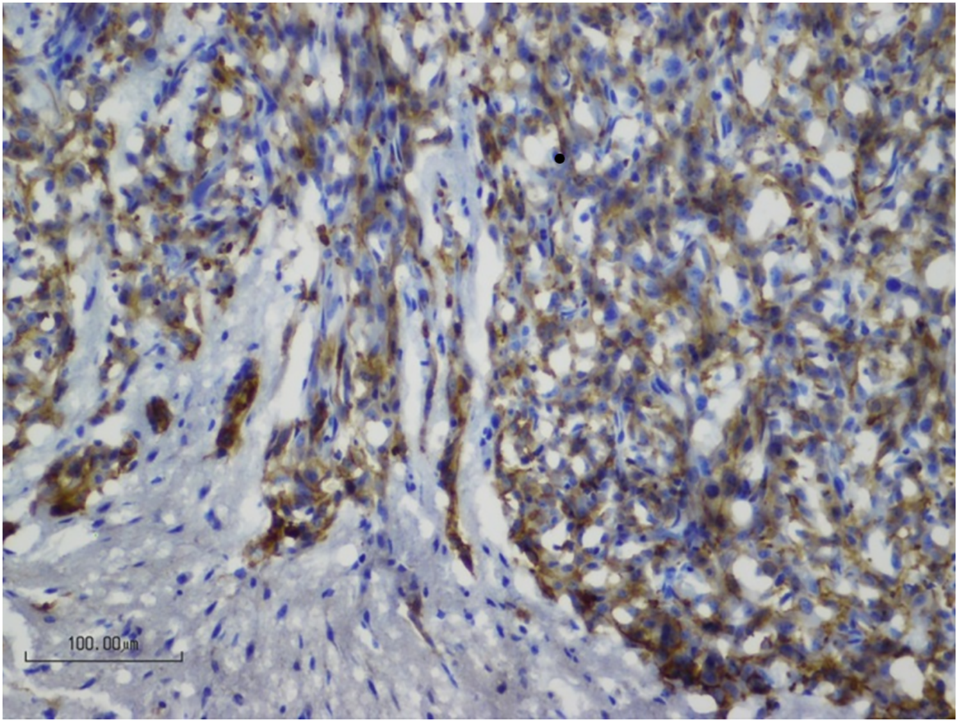 Research we funded: a novel serial biopsy technique