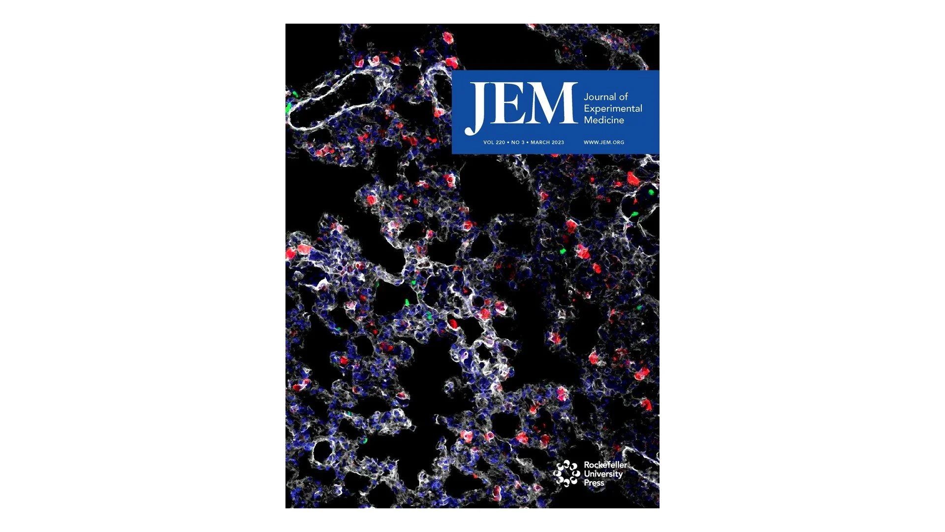 TREGS AT SITES OF VIRAL LUNG INFECTION