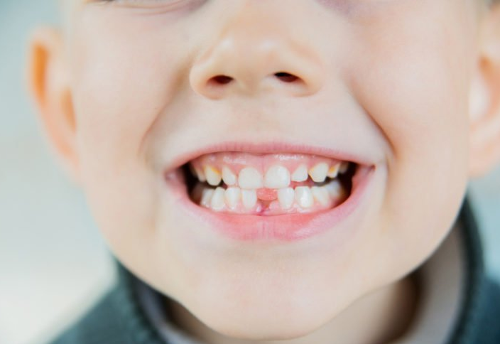EA J Periodontol submission