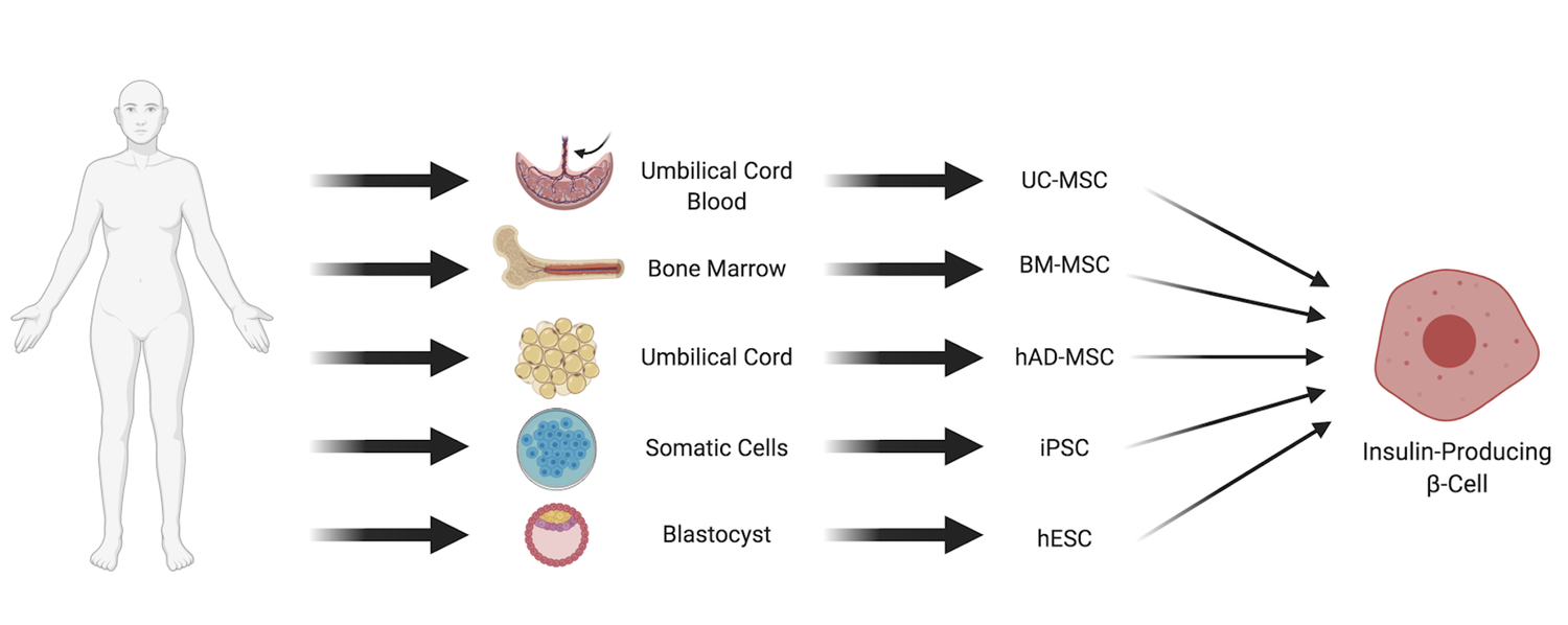 The Role of Stem Cell Therapy in Treating Type 1 Diabetes and ...