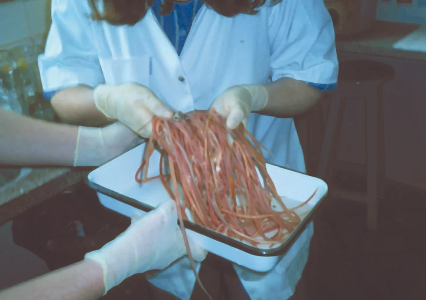 Ascaris lumbricoides adults removed from a single patient.