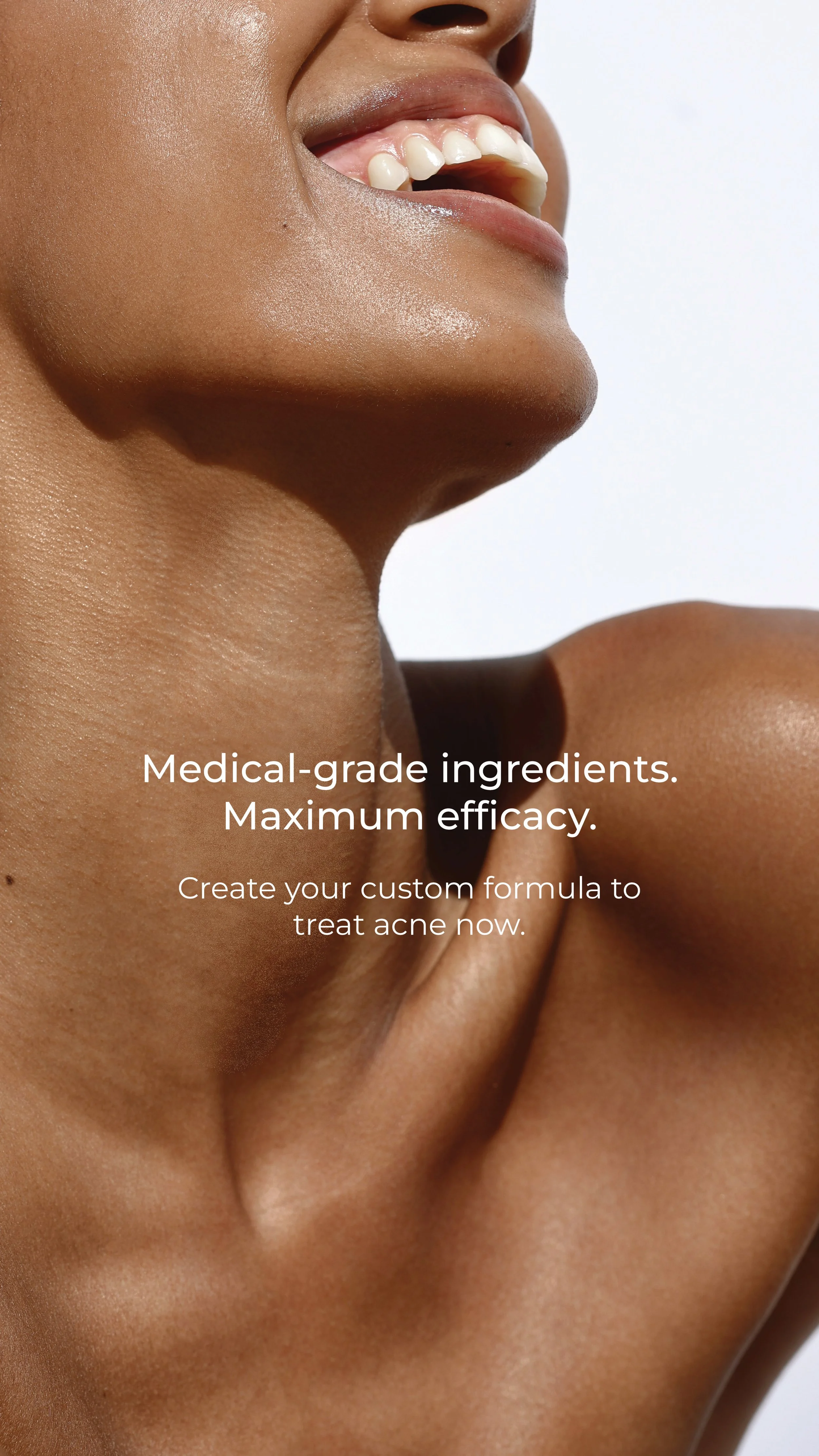 acne real results story 4.jpg