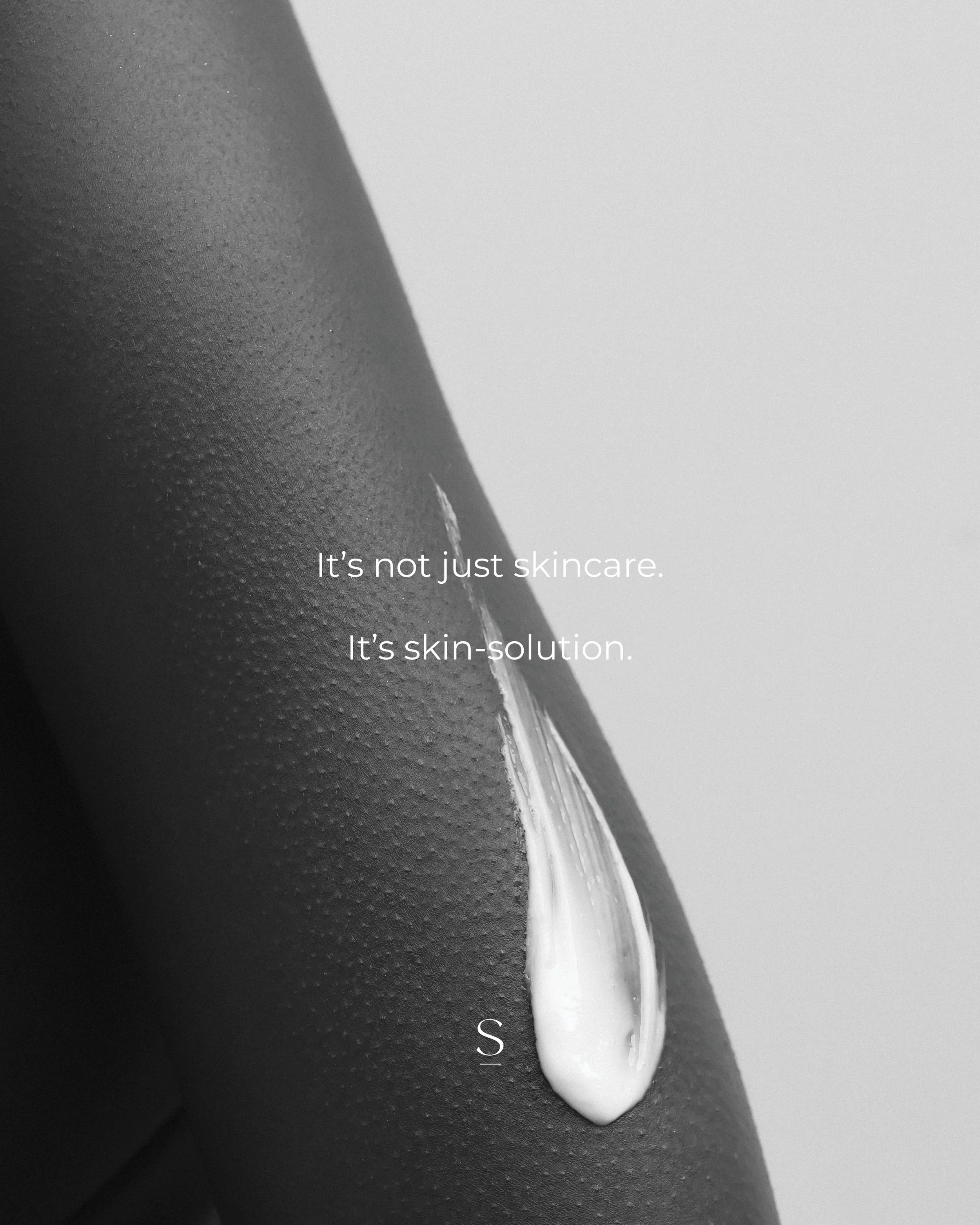 acne real results 11.jpg