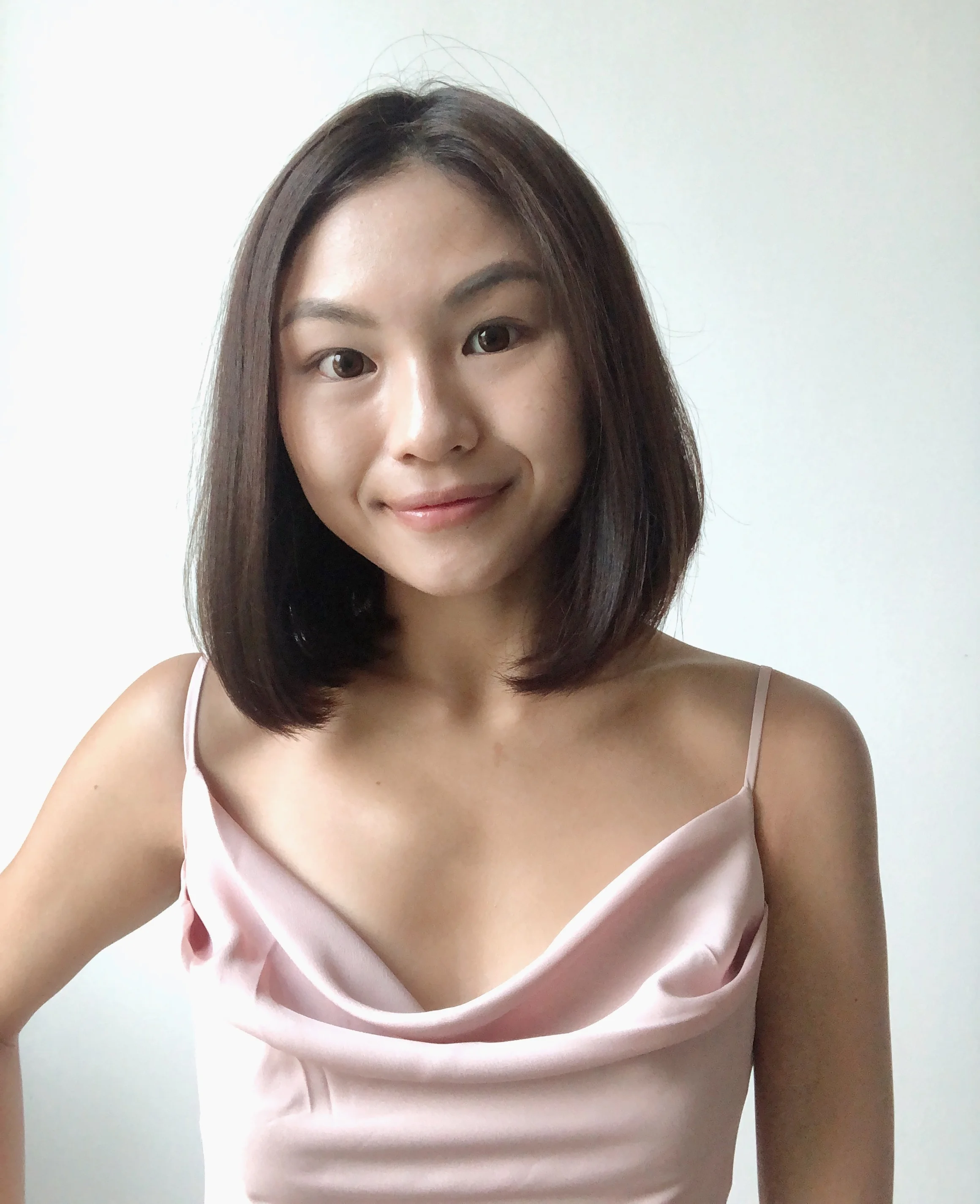 After: 18 July 2019 (whiteheads stop surfacing and subsiding from previous removal)