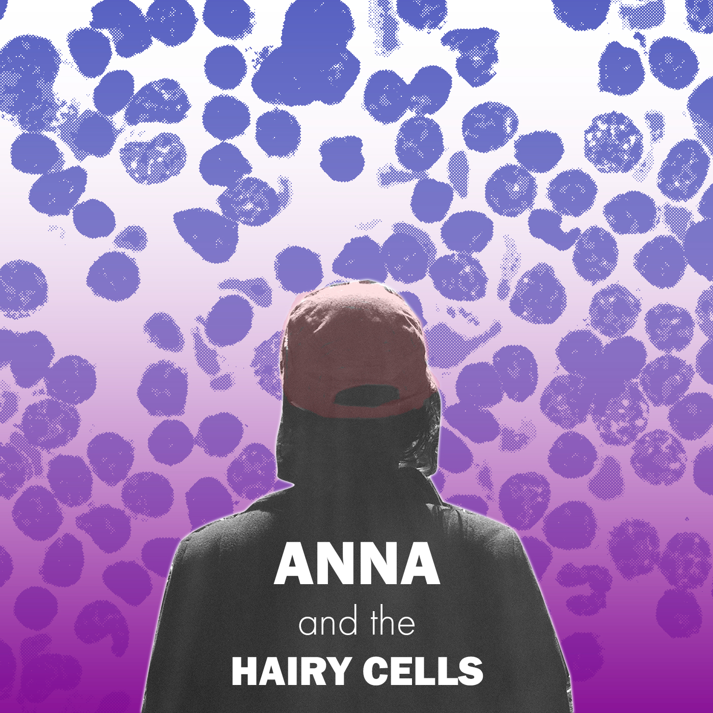 Episodes - Anna and the Hairy Cells