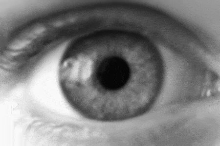 Dilate small.gif