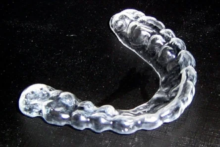 Custom whitening trays avoid problems.