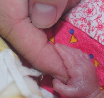 Premature babies are tiny!