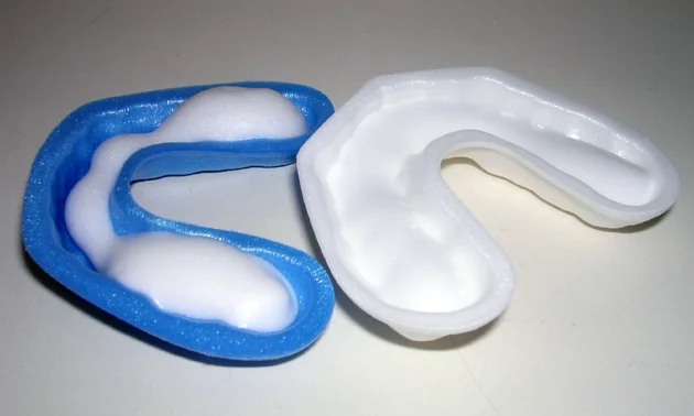 Fluoride, with it's great benefits for hardening tooth enamel, can cause staining if a patient ingests too much before their tooth enamel is fully formed.