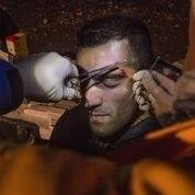 A Samu Dr stitching a man's eyebrow after being hit by a CRS officer with a baton