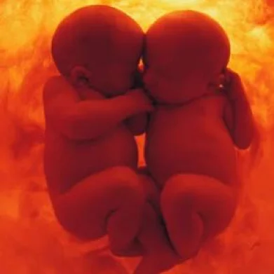 Guérison du jumeau né seul [séminaire]