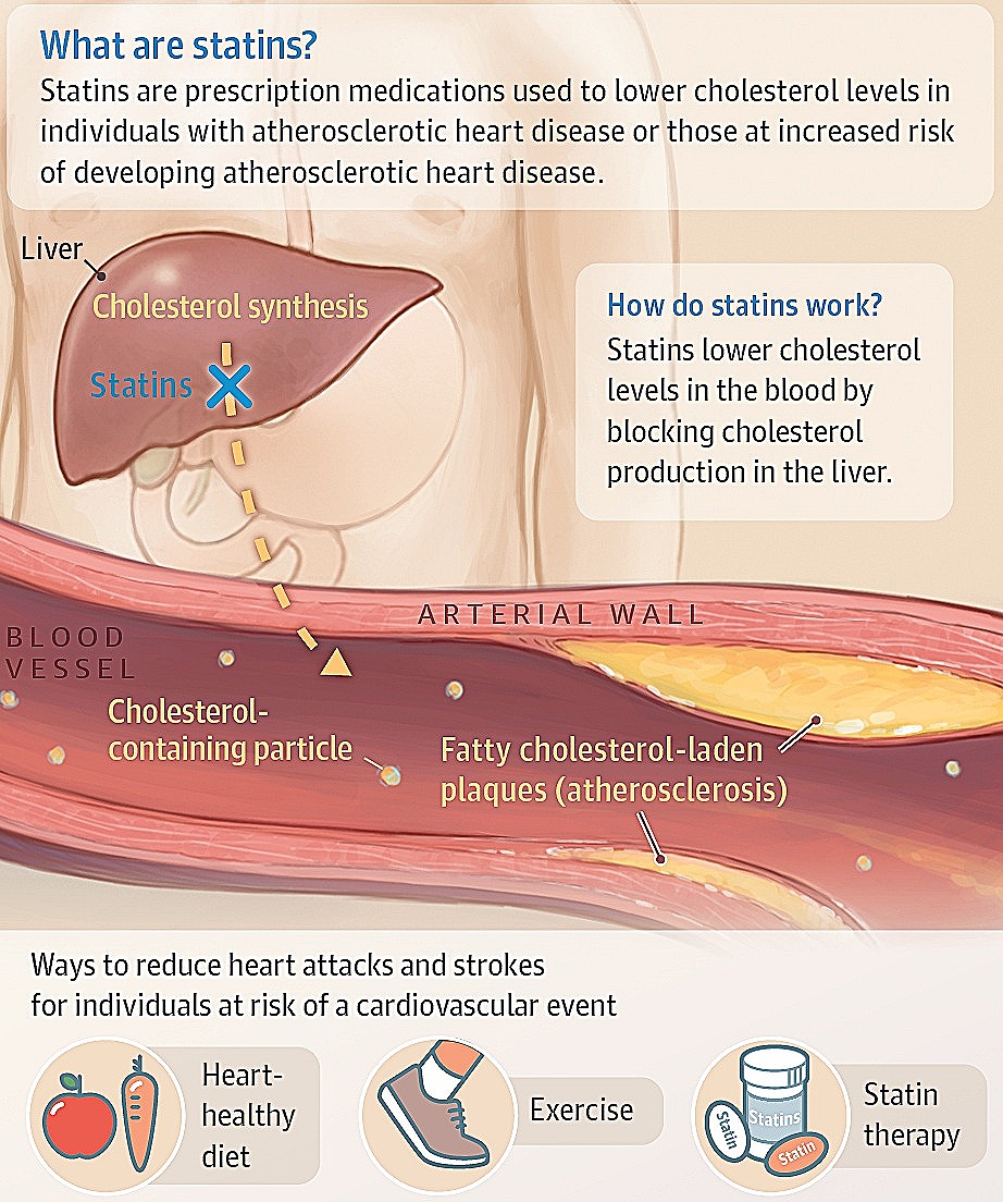 Fat Vs Water Soluble Statins Gt Health Endocrinology