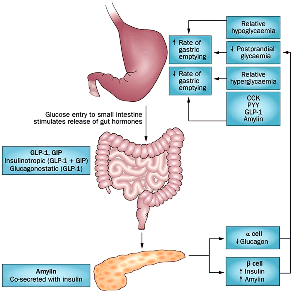 diabetic gastroparesis cause