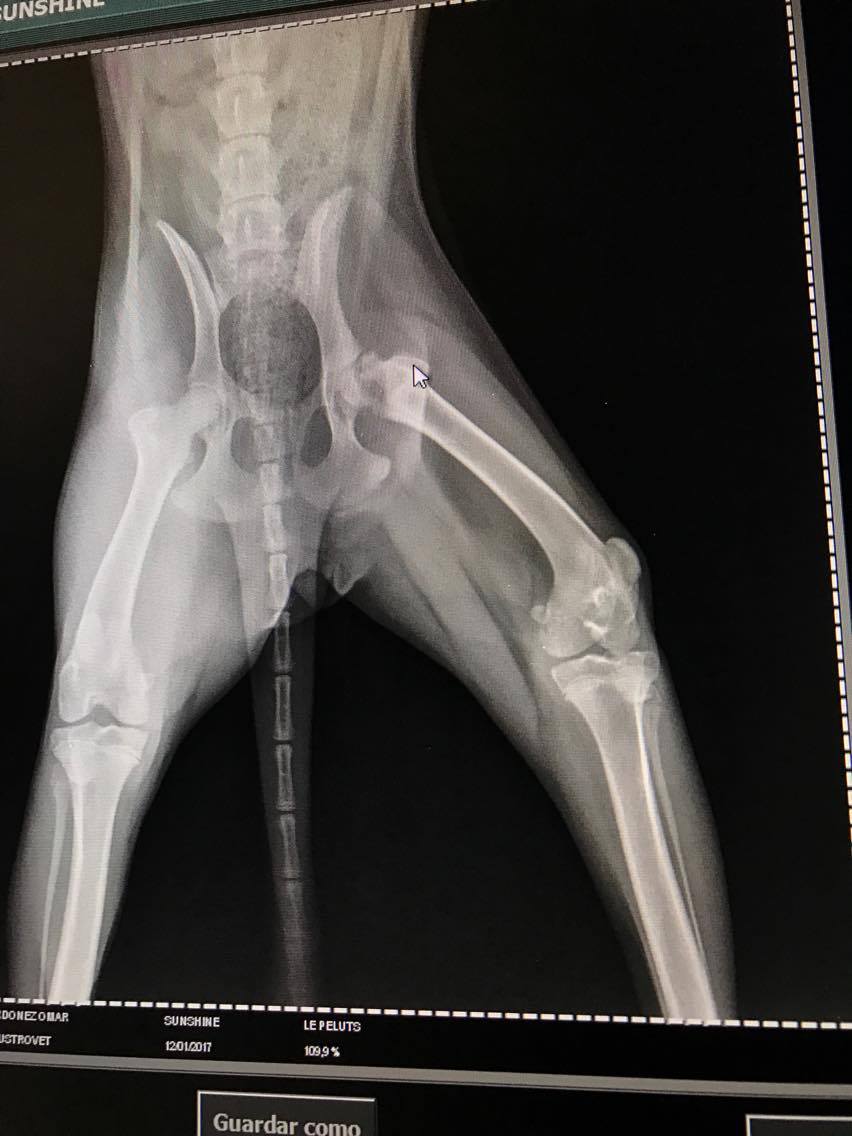 The femur ball joint had broken off from the femur and remained in the hip socket.