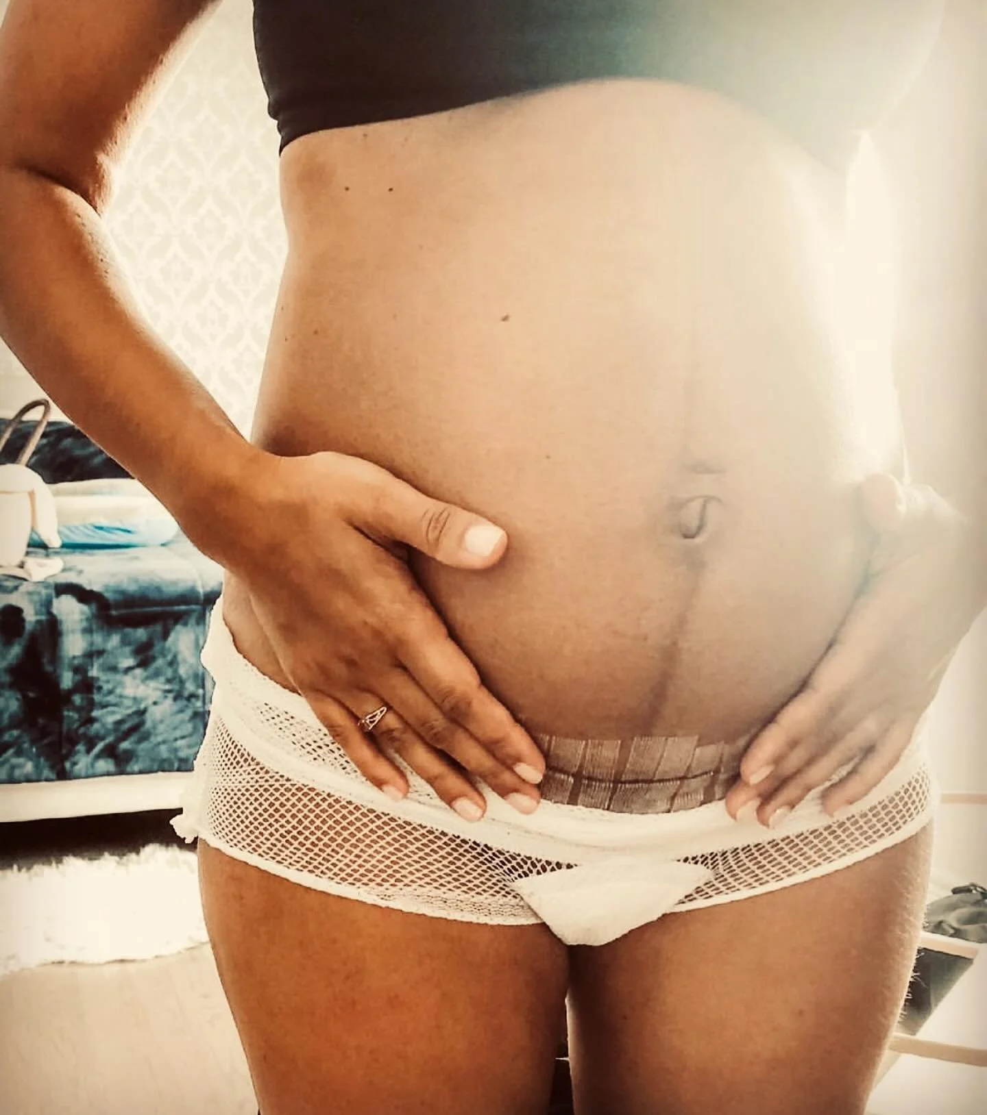 All our birth experiences are wildly different, and while I always advocate for bodywork for everyone in early postpartum I find it especially beneficial for folks who have experienced a medically managed birth. 

When we enter the hospital space, it