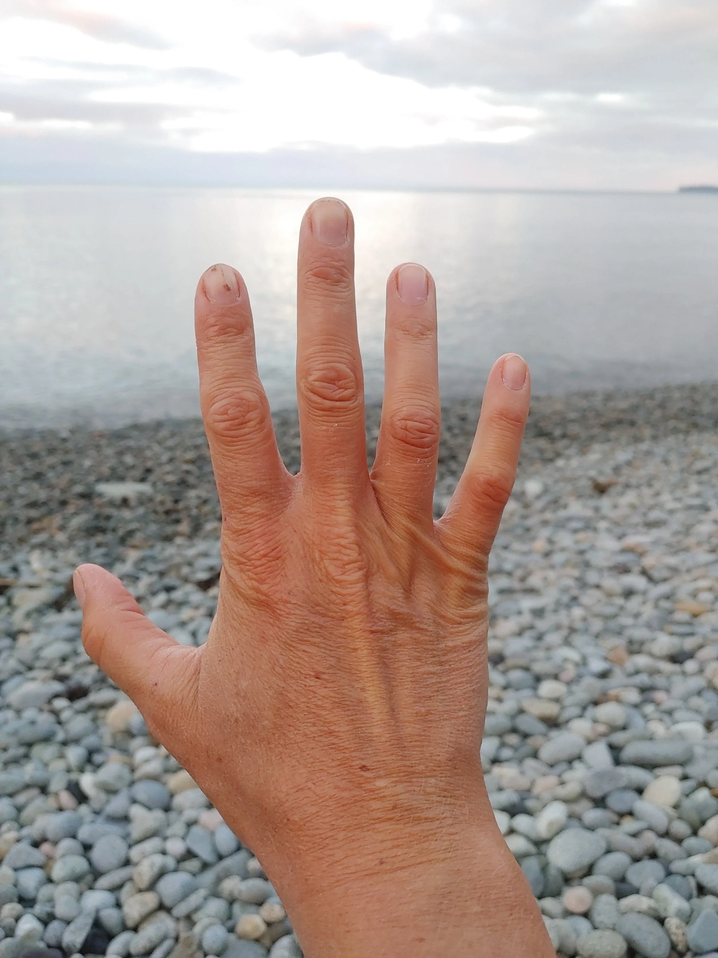 Checking in on the rapid aging of my paws
