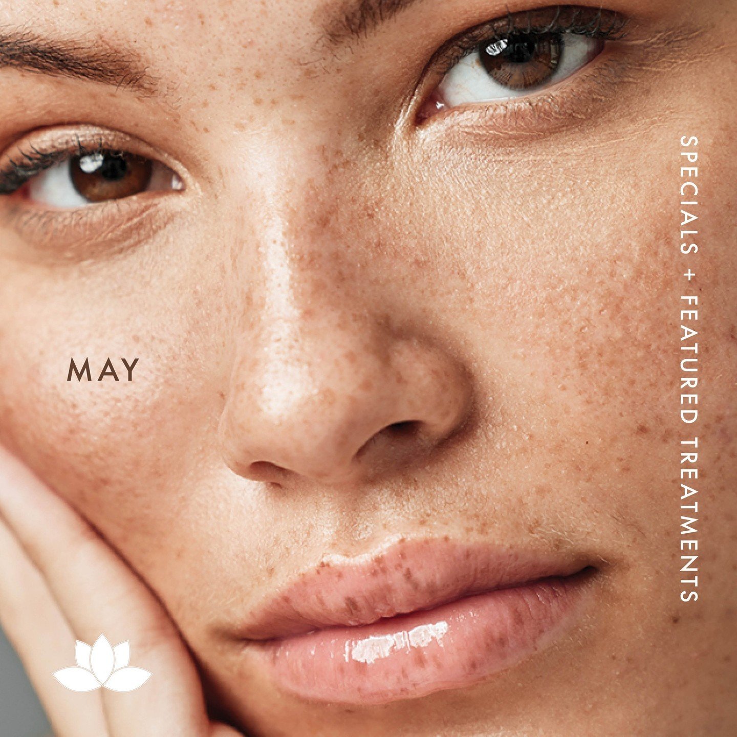 May is here! Swipe to take advantage of our amazing $1,000 savings on The Motherload &ndash; our ULTIMATE refresh package.⁠
⁠
🌸 Full Facial Balancing with Fillers addressing the Temples, Cheeks, Jawline and Lips.⁠
⁠
🌸 Biostimulators to Stimulate Co