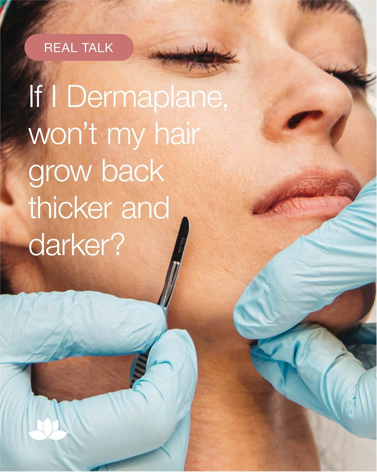 We hear this one all the time. The answer? Nope! 🙅🏻&zwj;♀️ That&rsquo;s a total myth. The fine peach fuzz on your face grows back the same as before, it just feels different at first because the ends are blunt. ✂️⁠
⁠
So what is Dermaplaning? 🍑 It&