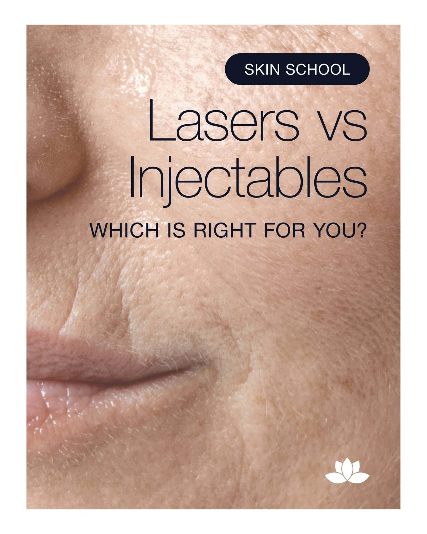 Lasers vs Injectables 💉🔆 Both transform your skin, but they do very different things.⁠
⁠
💉 INJECTABLES⁠
Work below the surface, softening lines, restoring volume, and subtly lifting for a refreshed look. They create structure and contour support.⁠