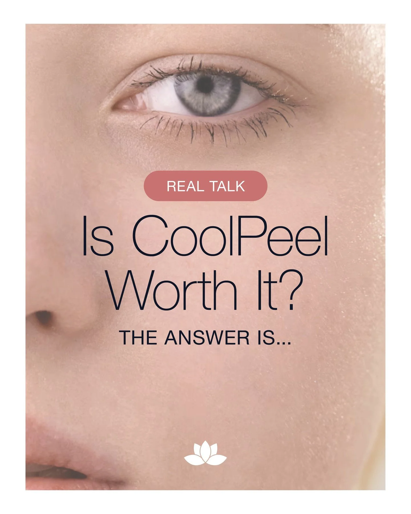 Yes! If you want visible results without weeks of downtime, CoolPeel is  worth it. ⚡️❄️ CoolPeel delivers the resurfacing power of a CO2 laser in a gentler, more controlled way. It smooths texture, softens fine lines, and brightens tone while keeping