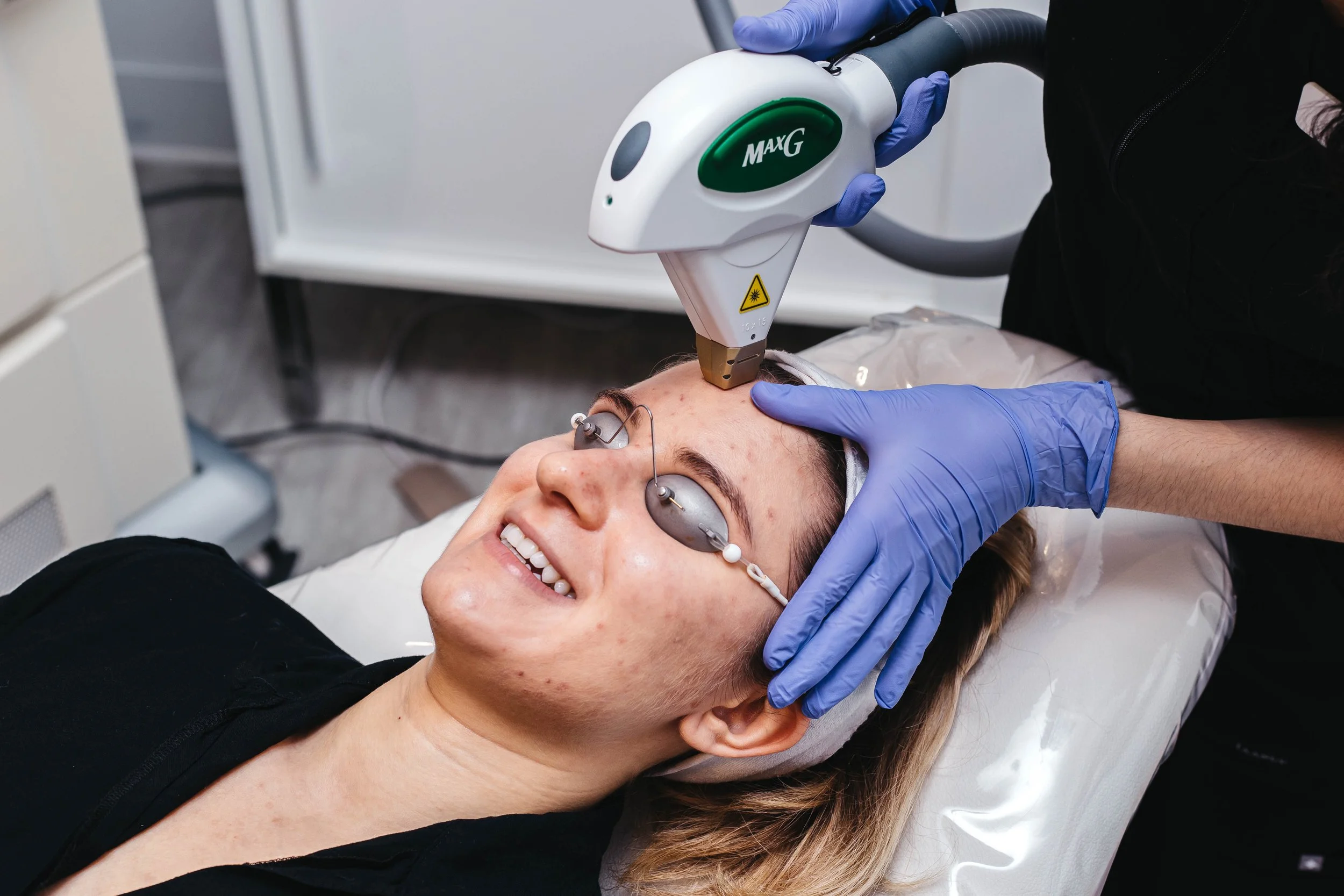 IPL + Microneedling for Acne Scars, Rosacea &amp; Skin Tightening