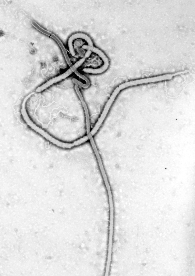 9b079-ebola_virus_em.png