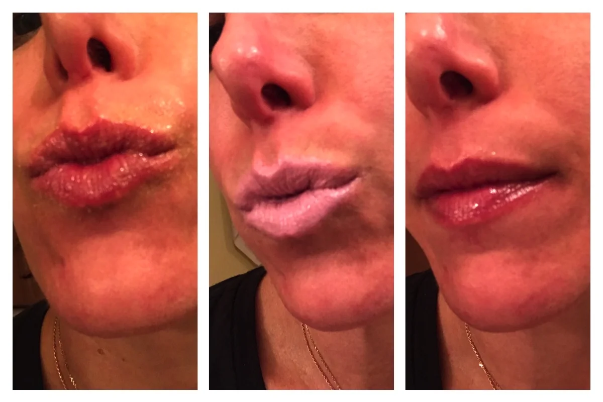 What Have You Done For Your Lips Lately Insiderbeautybuzz