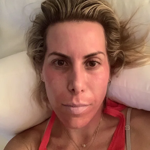 Let’s try to ignore the fact that I look like I have Bell’s palsy in this picture. And FYI, I’m wearing the Sara Happ Sweet Clay Lip Mask.