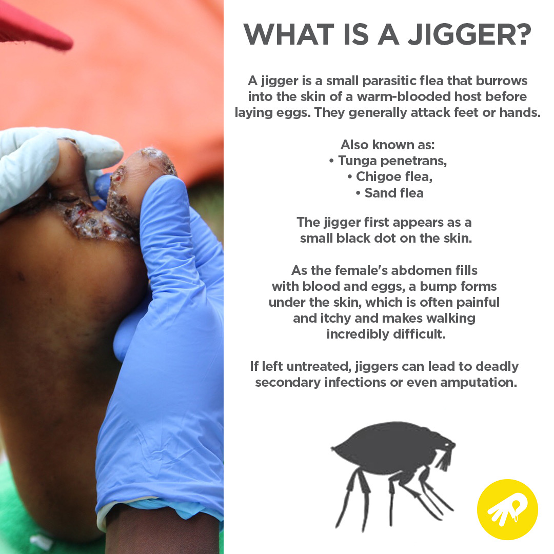 What-is-a-jigger.jpeg