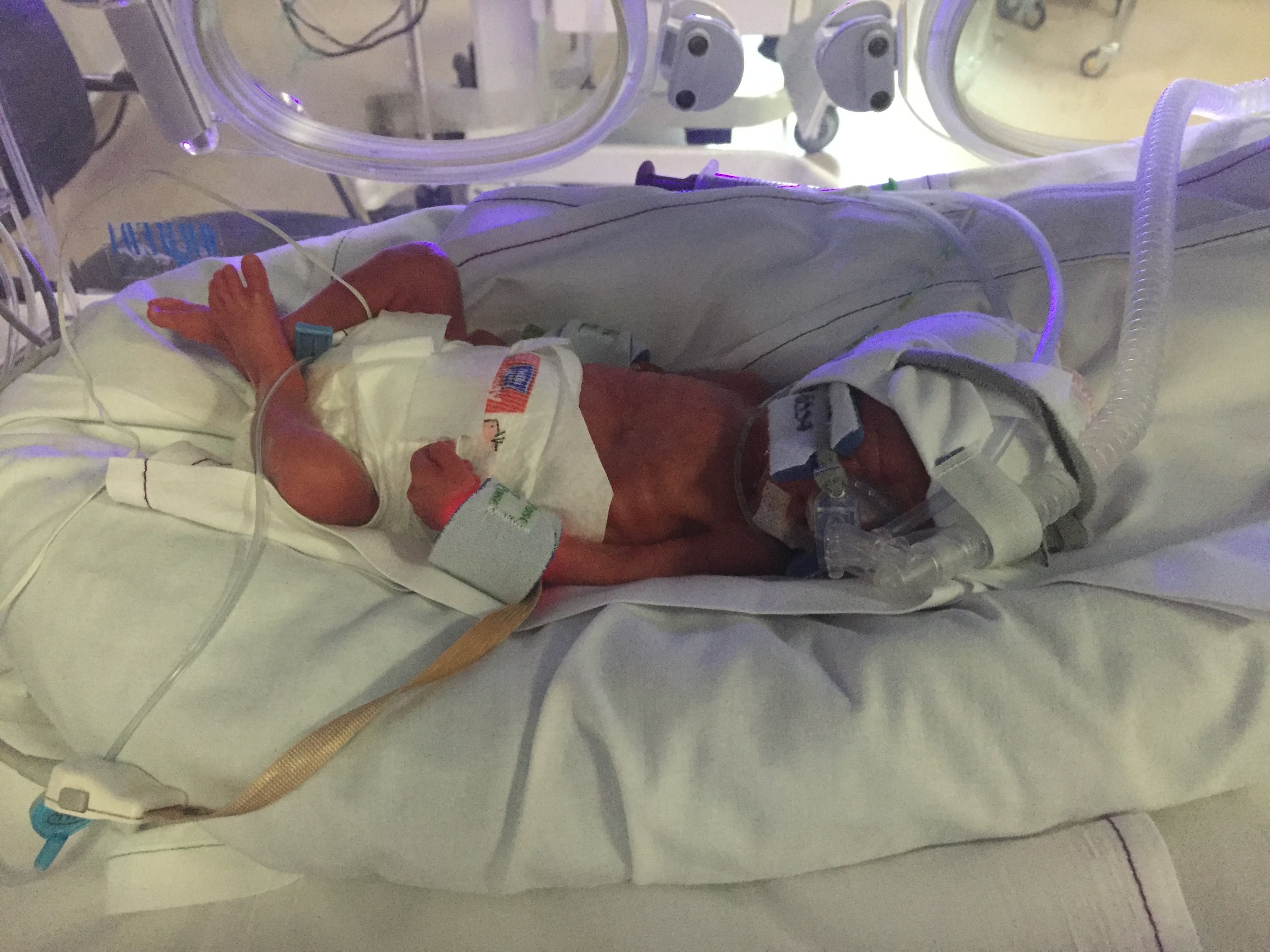 Sam in Nicu 1 day old