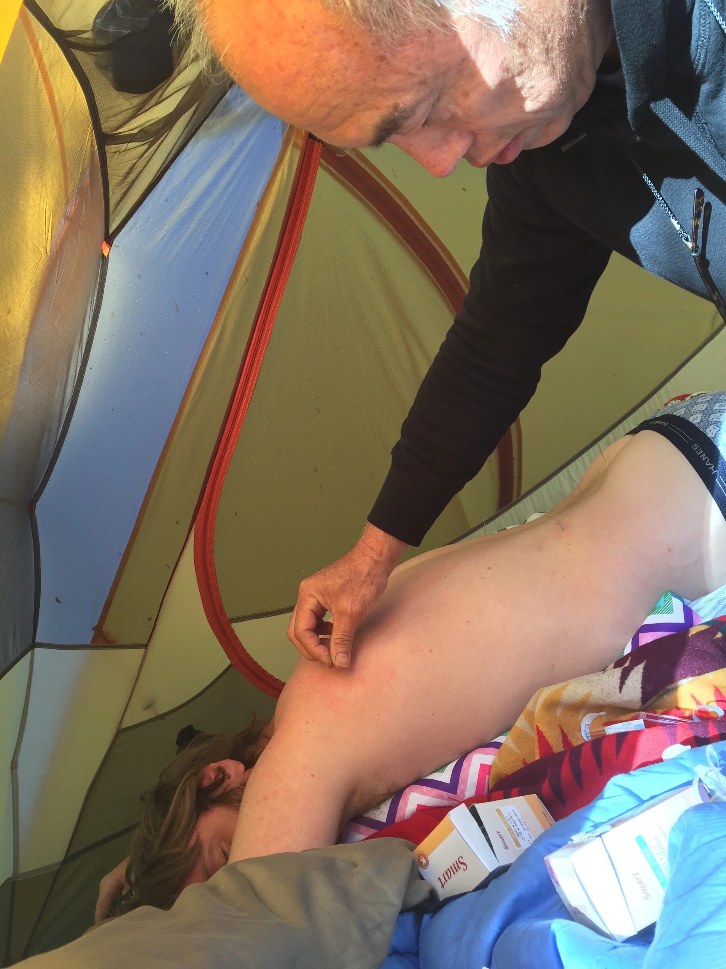 The National Park Tent Acupuncture perform by Dr. Chin