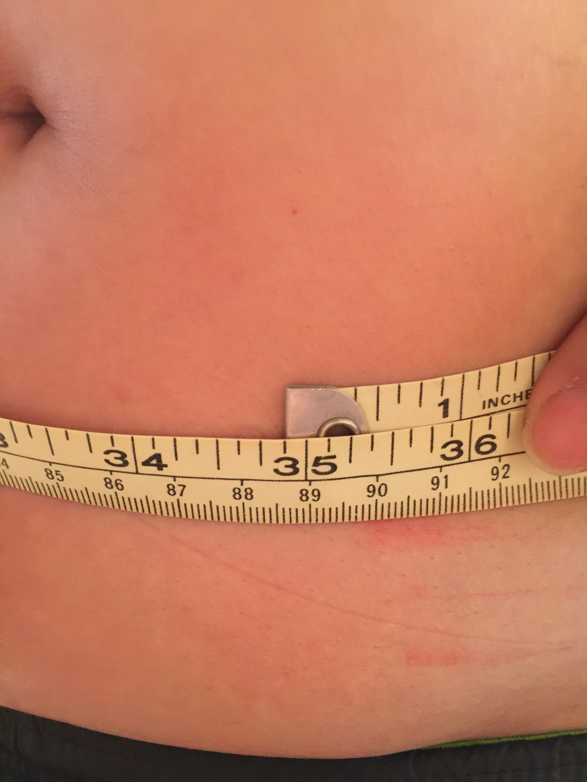 Acupuncture Weight Loss Treatment-- After treatment measurement