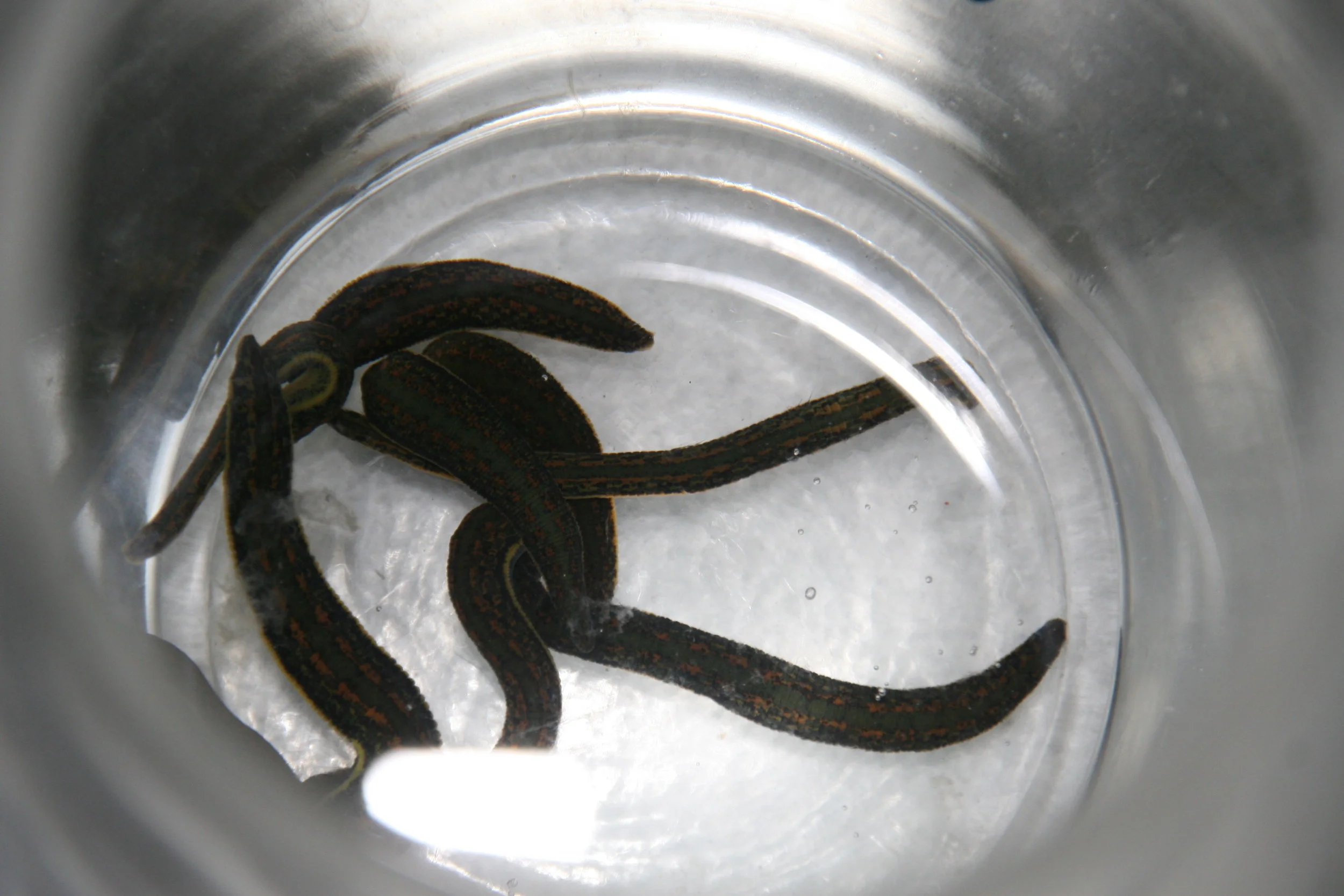 Medical Leech Therapy -- Before treatment 