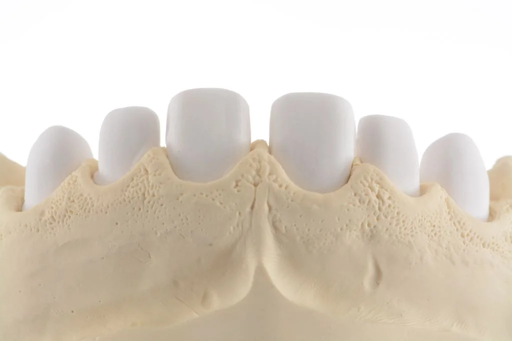 darlos soares 2.jpeg