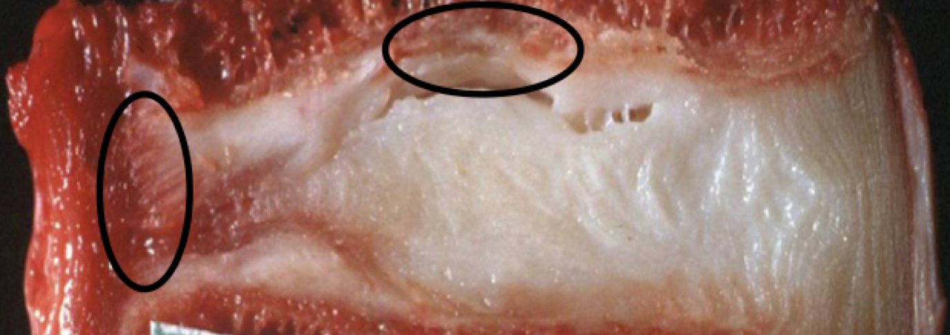 Jon sagittal MRI Feb 2014 square.jpg