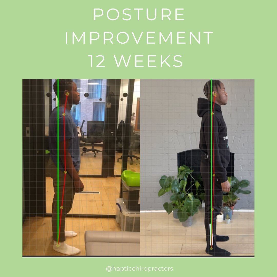 Progress Review Time! ✨

Meet one of our lush patients, Shadrack! He came in initially to see us for pain relief in his knee and hip due to a sports injury from football which was affecting his posture, general movement, flexibility, strength, and ba