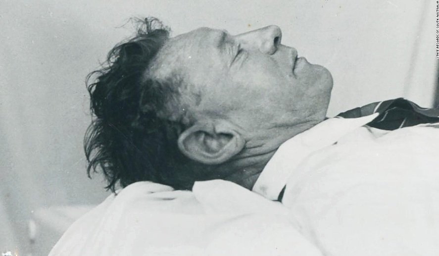  Post-mortem profile of the Somerton Man, taken by S.A. Police. From the S.A. State Records 