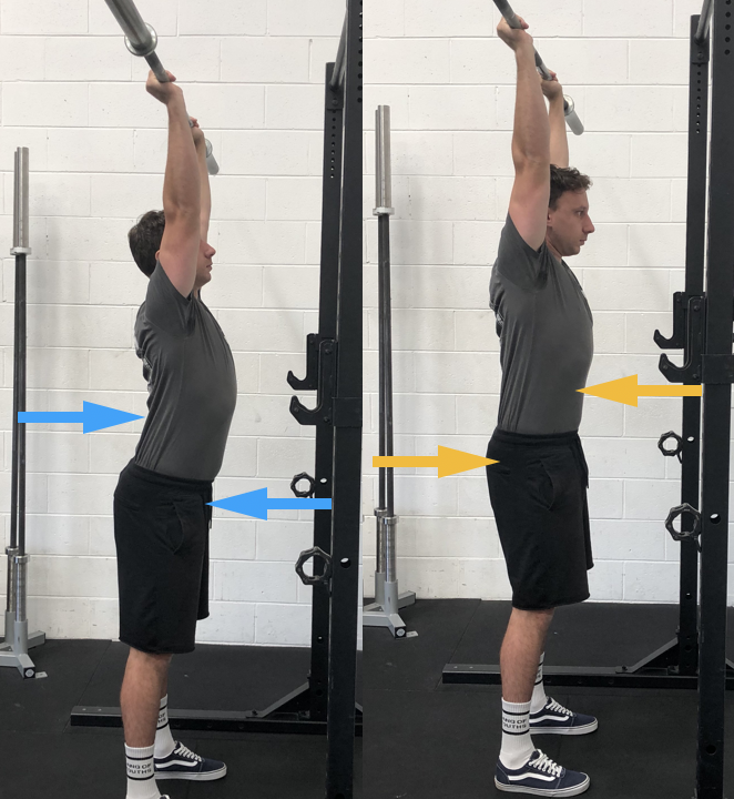 The spinal extensors are ‘stiffer’ than the glutes, anterior core and scapular upward rotators.