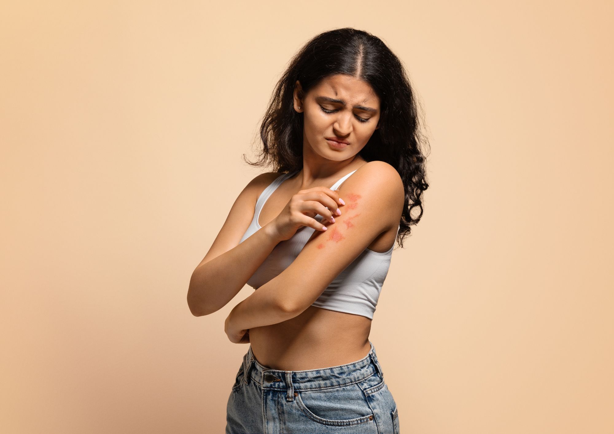 Why Does Your Eczema Keep Coming Back?