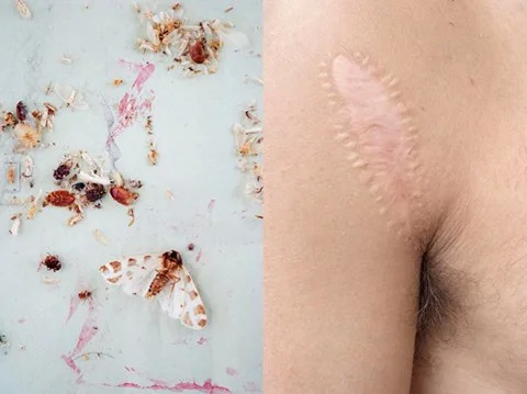 Scar, 19,5 cm x 29 cm