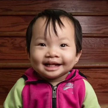 GAO FT Medical condition: cleft lip and palate