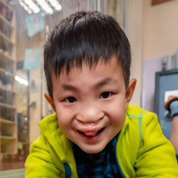 WU ZK Medical Condition: Cleft Lip & Palate